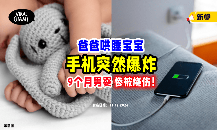 【很危险😱】爸爸哄睡宝宝「电话突然爆炸起火💥」9个月男婴惨被烧伤！