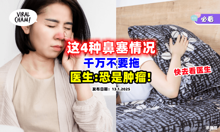 【超过10天就要注意❗】遇到「这4种鼻塞情况」不要拖⚡ 医生警告：恐是肿瘤！