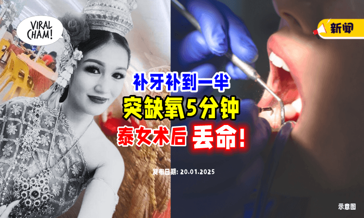 【补牙补到一半❗】泰国女子手术台上「缺氧5分钟⚡ 」结果3天后不幸毙命！