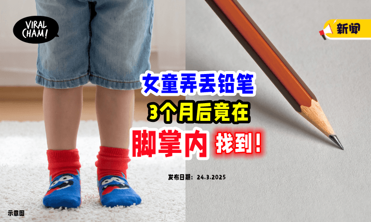 【铅笔不见了✏️】8岁女童「3个月后」就医才发现“它”竟在脚掌内😱！