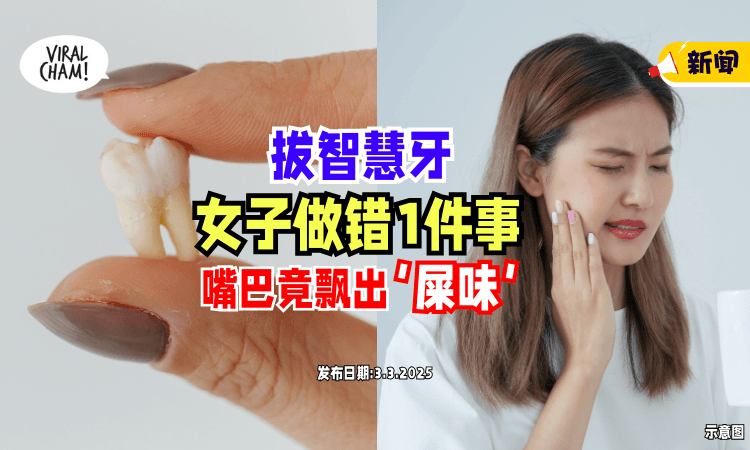 【拔牙后要注意❗】女子拔智慧牙「做错1件事⚡」竟导致口腔飘出“屎味”！
