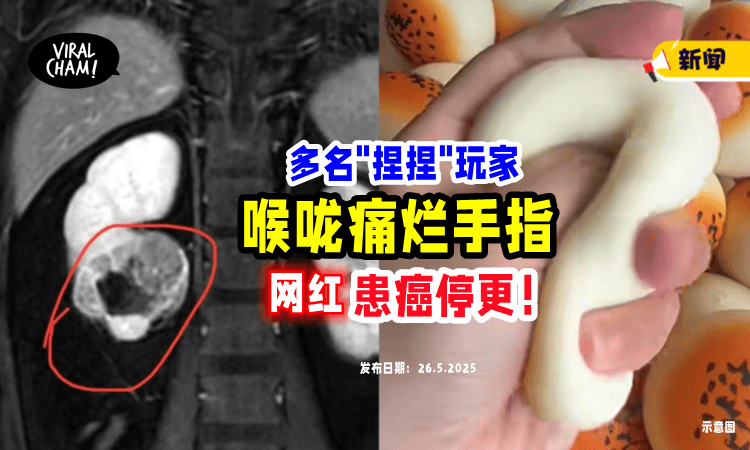【“捏捏”有毒⁉️】网红自爆「患癌停更⚡」多名玩家出现喉咙痛、烂手指情况！