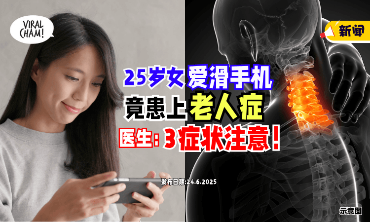 【长期低头滑手机❗】25岁女子惊患「老人症⚡」医警告 : 出现“3症状”注意！
