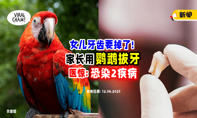 【千万不要尝试❗】家长用「鹦鹉帮女儿拔牙」引热议⚡ 医惊：恐感染2疾病！