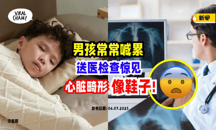 【连书包都没力拿❗】男童心脏变形「像鞋子一样⚡」医惊：出现“这些症状”要留心！