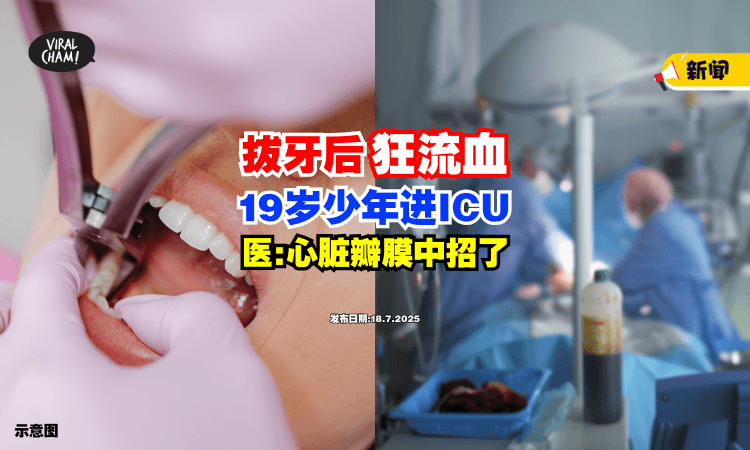 【存钱去绑牙❗】19岁少年「拔牙后狂流血」进ICU⚡ 医生：心脏瓣膜中招了！