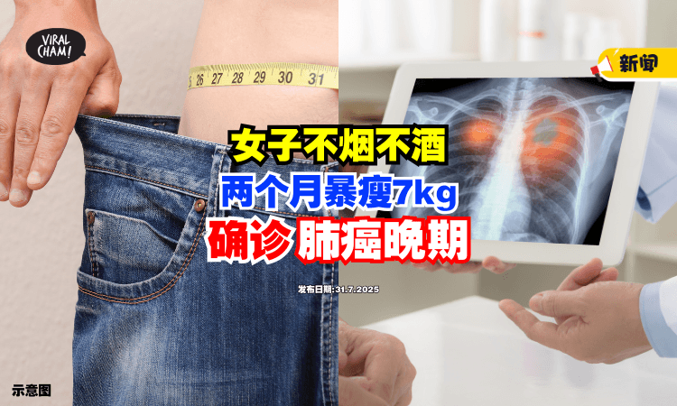 【两个月暴瘦7kg❗】女子无烟酒习惯确诊「肺癌末期⚡」医生摇头：太晚了！