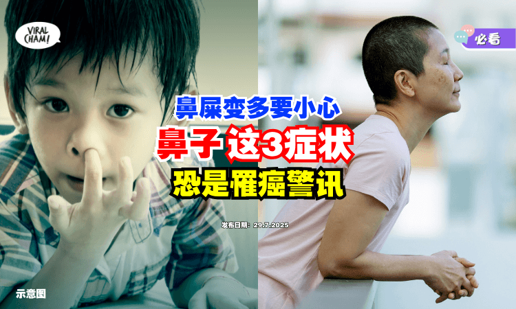 【鼻屎突变多要小心❗】医生提醒出现「这3种症状⚡」恐是罹癌警讯！