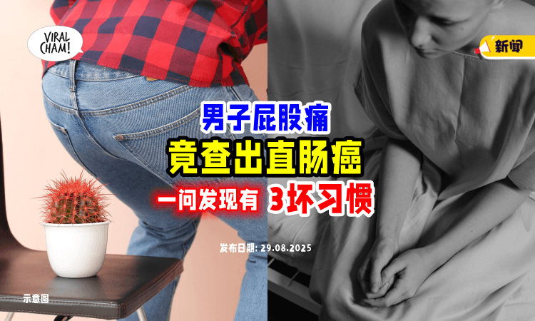 【不是痔疮发作❗】52岁男骑车感觉「屁股痛痛」竟是直肠癌⚡ 一问发现有“3坏习惯”！