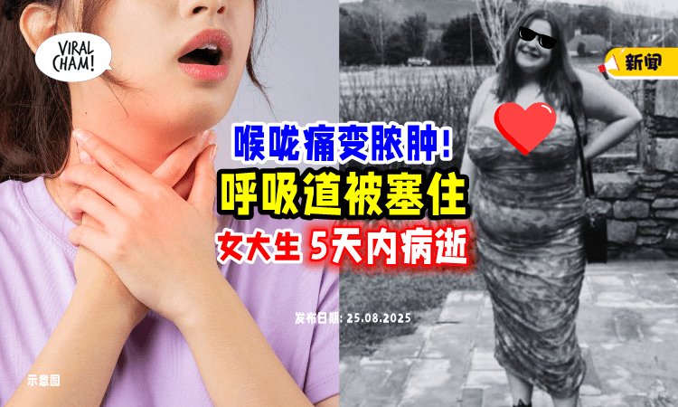 【病情迅速恶化❗】22岁女大生喉咙痛就医⚡ 5天内「脓肿阻塞呼吸道」不幸离世！