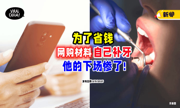 【千万别学❗】男子为省钱「上网买材料」自己补牙⚡ 一张口就悲剧了!