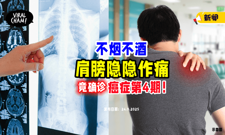 【肩膀隐隐作痛❗️】男子「不抽烟不喝酒」竟查出10公分肿瘤⚡ 确诊癌症第4期！