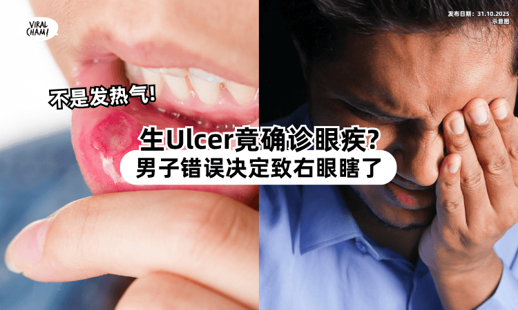 【以为只是发热气❗】20年来狂生Ulcer竟确诊眼疾⚡ 男子「1错误行为」导致永久失明！