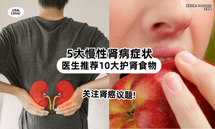 【敲响肾癌警钟❗】医生分享5大慢性肾病症状⚡ 推荐食用「10大护肾食物」