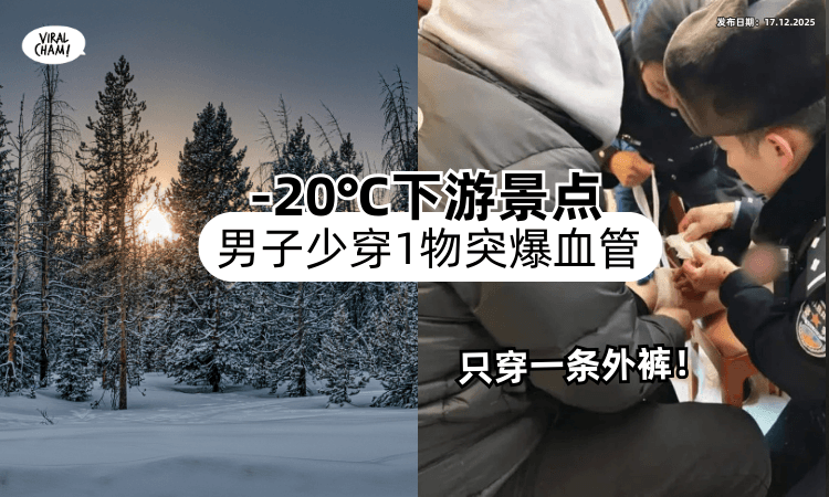 【只穿一条外裤❗】-20℃下游景点⚡30岁男子「少穿一物」逛街突然爆血管！