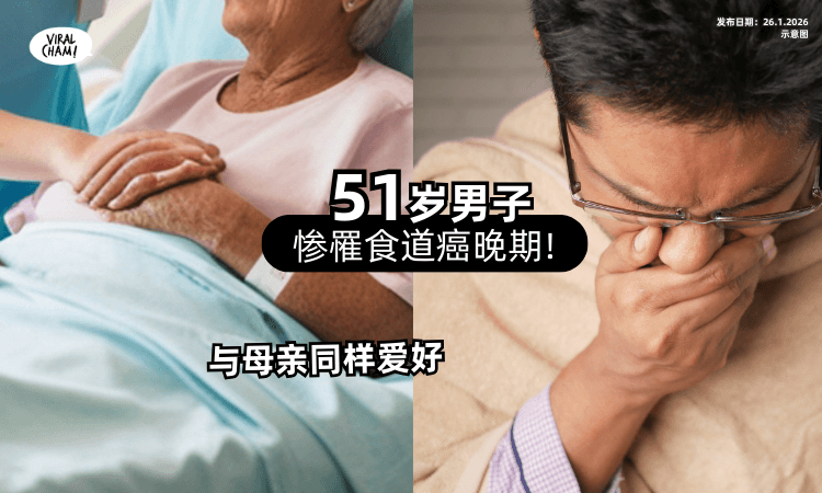 【母亲9年前病逝】51岁男子因「同1爱好⚡」惨罹食道癌晚期❗