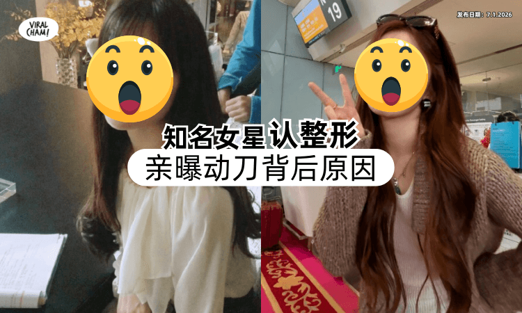 【参加浪姐后再被关注❗】知名女星「大方承认整形⚡」还亲曝动刀背后原因！