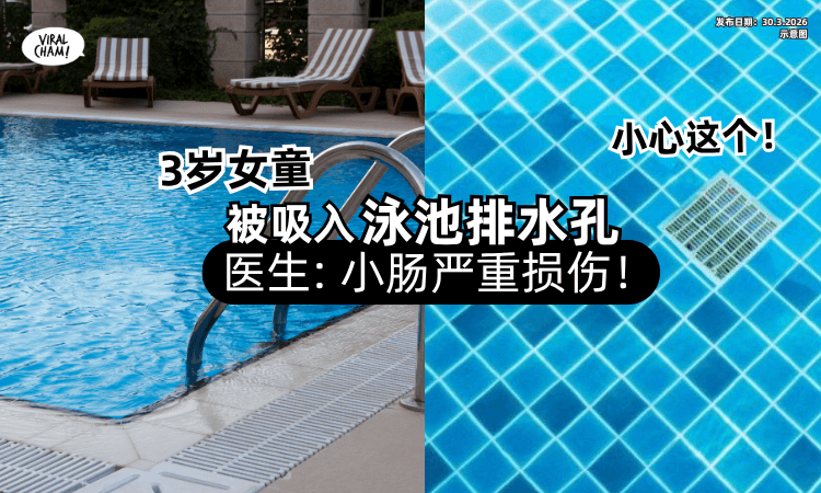 ​【恐怖意外❗】3岁女童被「吸入泳池排水孔」送医惊见⚡小肠严重损伤！