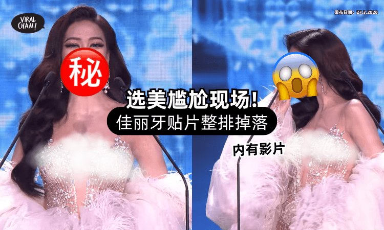 【大型社死现场❗】选美到一半「牙贴片」整排脱落⚡ 超尴尬瞬间全被录下！