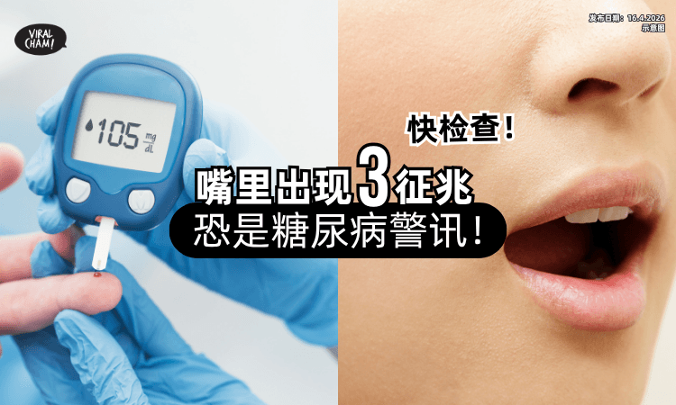 【快Check下❗】嘴里出现「3征兆」恐是糖尿病⚡ 牙医 : 是头号警讯！