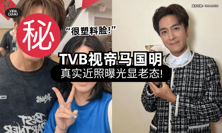 【“老态”毕现❗】52岁马国明和粉丝合照⚡ 面部松弛「满脸皱纹」吓坏网友：塑料感很重！