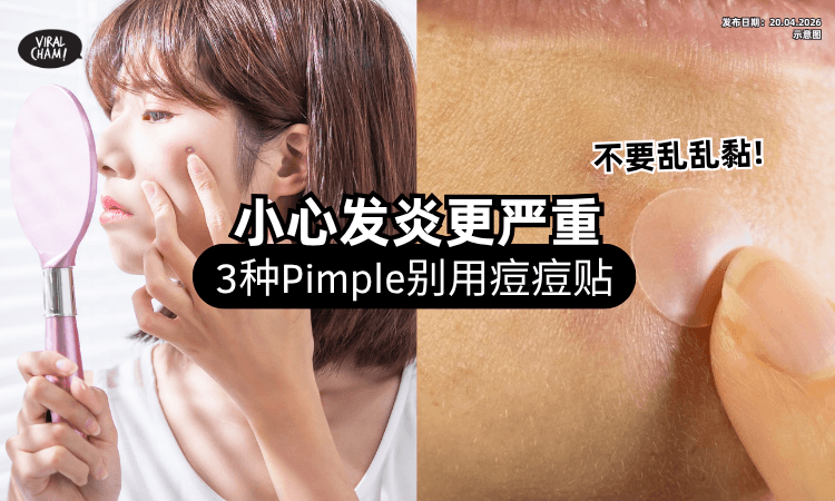 【小心弄到烂脸❗】专家曝「3种Pimple」別用痘痘贴⚡ 警告：发炎程度恐变严重！