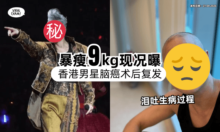 【术后脑癌扩散❗】香港知名歌手抗癌「暴瘦9KG」现况曝光⚡ 泪吐开刀惊险过程！