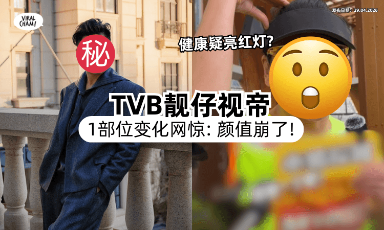 【Chok样都不见了❗】45岁TVB视帝「一部位」状态曝光⚡ 疑健康亮红灯：神颜被拖垮！
