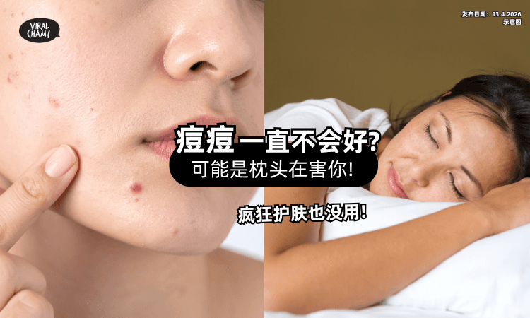【痘痘一直好不了❓】 未必是皮肤问题⚡ 可能是「枕头」在害你!