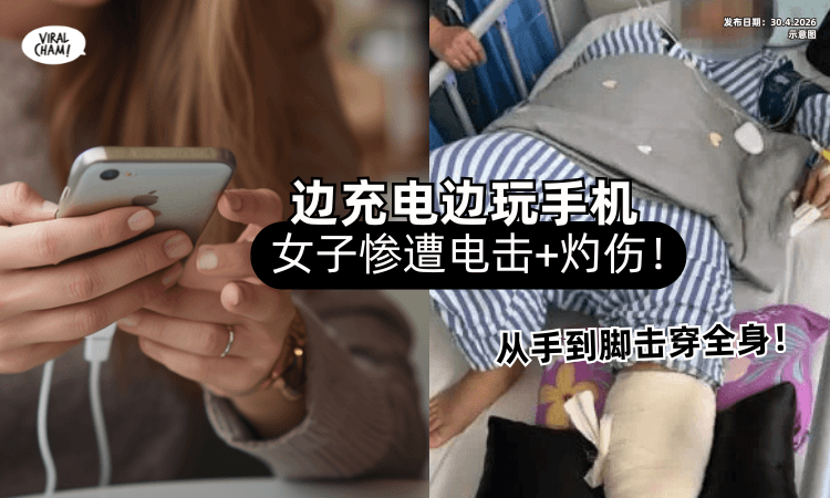【从手到脚击穿全身❗】边Charge电边滑手机⚡ 女子惨遭「电击+灼伤」被送进ICU！
