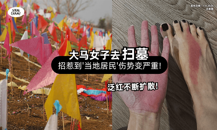 【行清要注意安全❗】大马女子去扫墓「脚趾被1虫咬⚡」以为只是小事结果麻烦了!