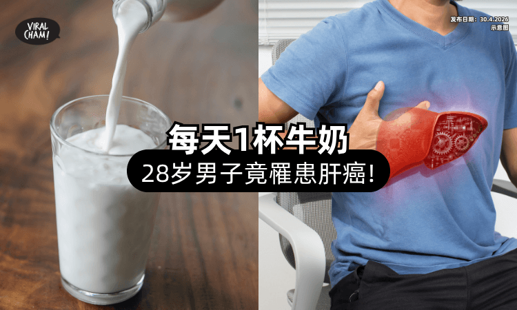 【每天1杯牛奶❗】28岁男子「竟得肝癌⚡」医生曝关键原因！