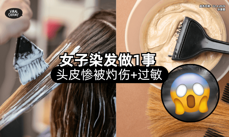 【设计师曾劝阻❗】女子去Salon染发「做1事」头皮惨被灼伤⚡ 竟要求赔偿！