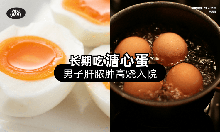 【别以为很健康❗】男子长期吃「溏心蛋⚡」竟患肝脓肿高烧进院！