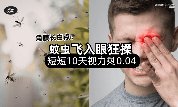 【蚊虫飞入眼狂揉❗】男子短短10天「视力仅剩0.04⚡」医生见白点 : 溃烂了！
