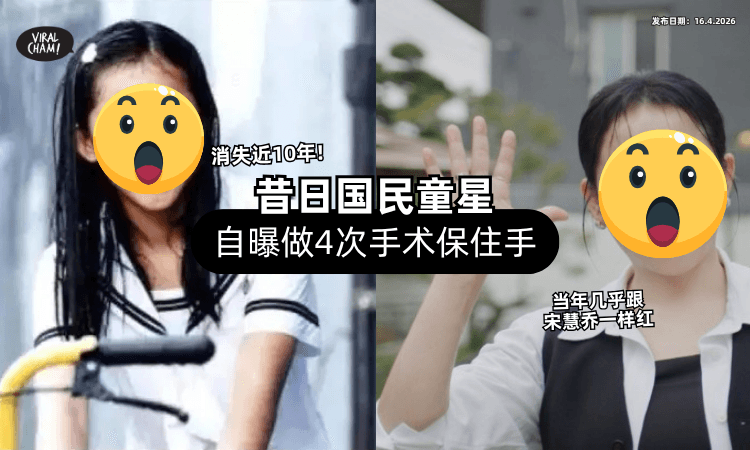【消失近10年❗】昔日国民童星露脸圆了一圈⚡ 自曝做了「4次手术」保住手臂！
