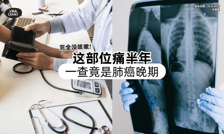 【完全没有咳嗽❗】女子这部位痛半年找不到原因⚡ 一Check竟确诊「肺癌晚期」