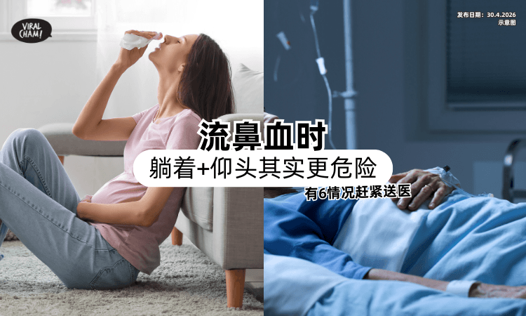【很多人做错❗】流鼻血躺着+仰头其实更危险⚡「出现6情况」一定要送医！