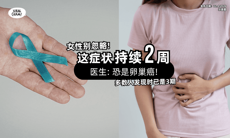 【女性别忽略!】医生示警「这症状持续2周」恐是卵巢癌⚡ 多数人发现时已是3期❗