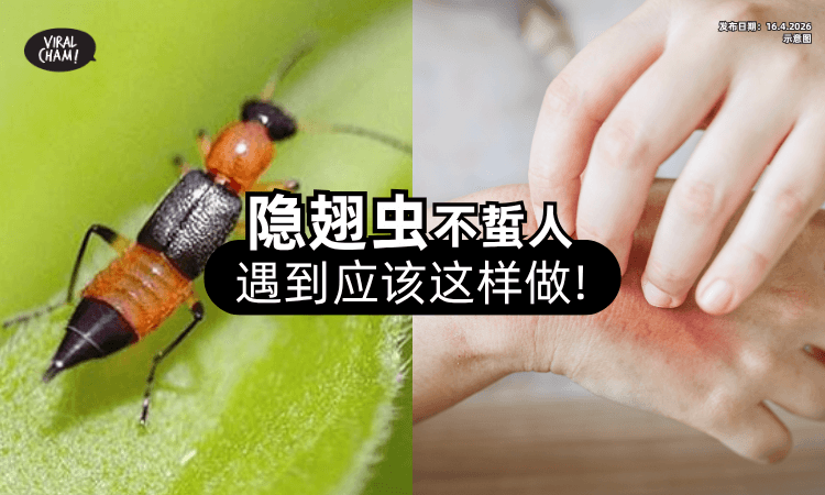 【别急着拍打❗】隐翅虫「不会主动叮咬」应激即释放毒素⚡ 遇到可以这样做！