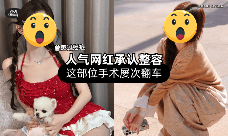 【曾患甲状腺癌❗】人气网红大方「承认整容⚡」自曝这部位手术屡次翻车！　