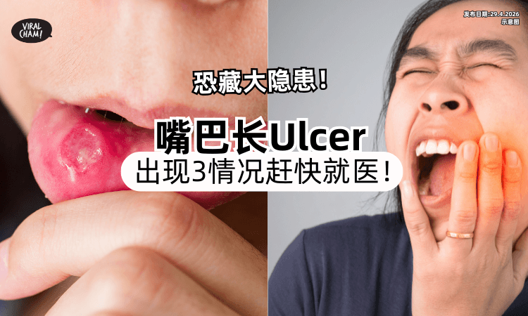 【恐藏大隐患❗】嘴巴长Ulcer需警惕⚡医生提醒 : 出现「3情况」赶快就医！