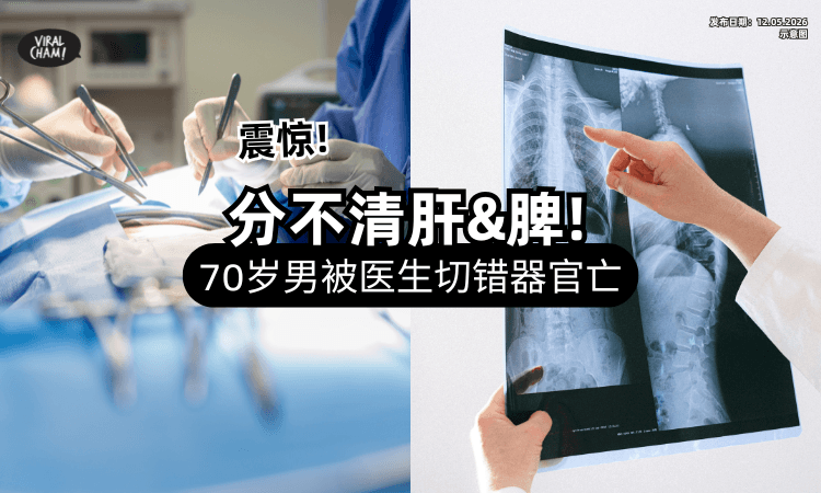 【腹痛想回家治疗❗】70岁Uncle遭劝动刀⚡ 医生「肝脏当脾脏切」惨死在手术台！