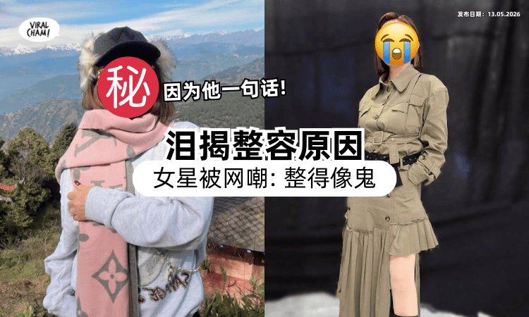 【变很大❗】台湾知名女星挨酸「整得像鬼」哭了⚡ 首公开整形原因：鼻子快被挖空！