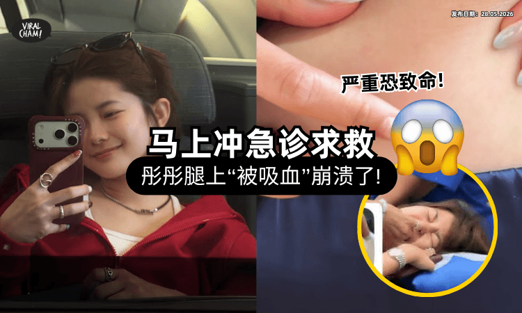 【严重恐致命❗】YouTuber彤彤惊见腿上被「这种虫」吸血⚡ 不敢自己拔急冲诊所！