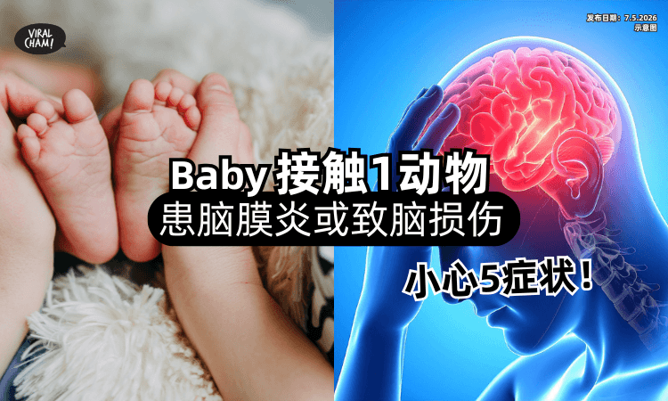 【小心5症状❗】1岁女童「接触1动物」患脑膜炎⚡ 医生 : 或致继发性脑损伤！