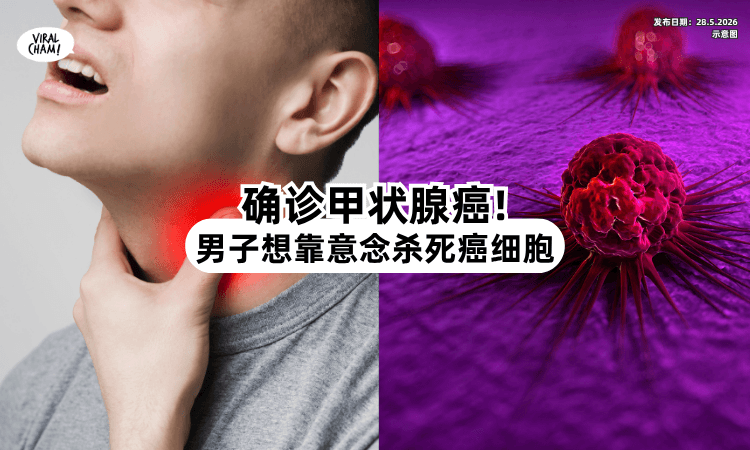 【不想开刀❗】30岁男子竟想「靠意念」杀死癌细胞⚡ 医生这样说！
