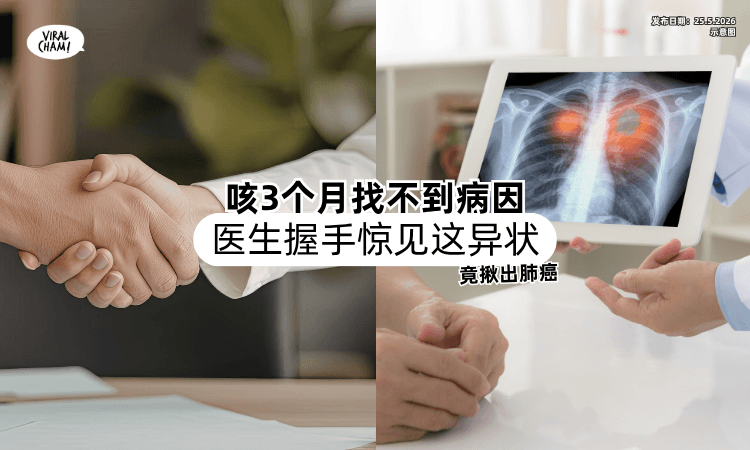【干咳了3个月❗】男子找不到病因⚡ 医生一握手「惊见这异状」揪出肺癌！