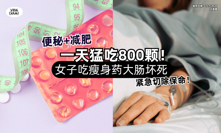【一天服用800颗❗】27岁女子长期「吃瘦身药」大肠坏死⚡ 紧急切除保命！