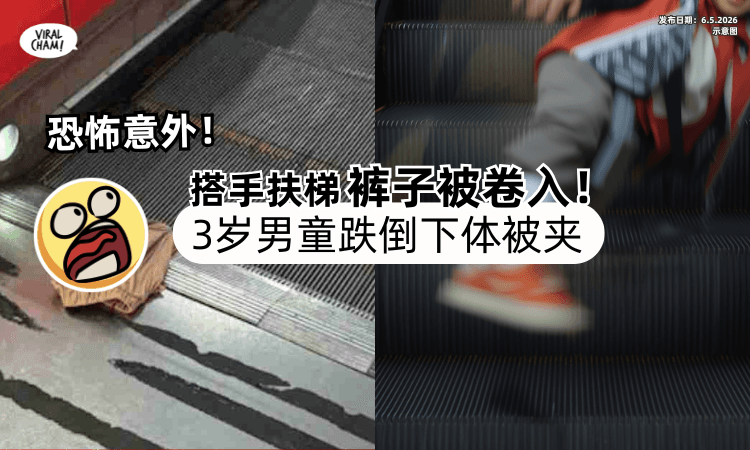 【家长要注意❗】3岁男童搭Escalator「裤子被卷入」往前跌⚡ 下体惨被夹！